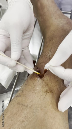 First aid for shin wounds