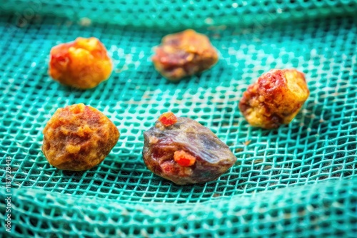 Surgical gauze reveals gallstones following a laparoscopic cholecystectomy; a medical photography example. photo