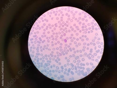 Plasmodium vivax is a protozoal parasite and a human pathogen. This parasite is the most frequent and widely distributed cause of recurring malaria. photo