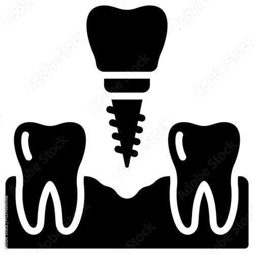 Dental Implant Icon