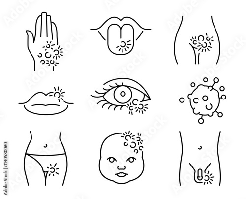 How genital herpes affects a human body.