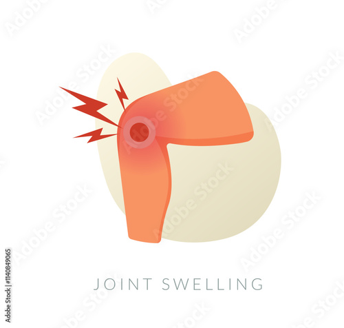 Calf Muscle Pain - Joint Swelling - Stock Illustration