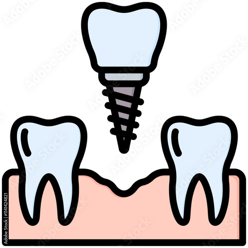 Dental Implant Icon