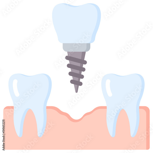 Dental Implant Icon