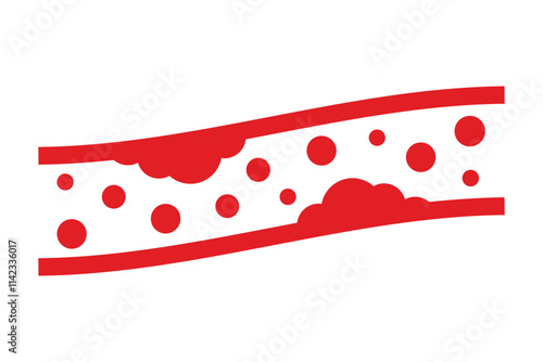High blood cholesterol colorful icon with a arteriosclerosis risk. Clogged artery. Concept of high cholesterol and unhealthy lifestyle, fast food. thrombosis microvascular disease. Vector illustration