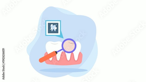 cracked dental crown Fractured Teeth Exam using Mouth mirror animation, Checking Tooth explorer sickle probe animated video, Dentistry Clip, Oral Healthcare footage, Dental instrument motion graphics