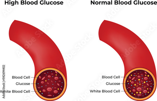 High Blood Glucose Normal Glucose Design Vector Illustration