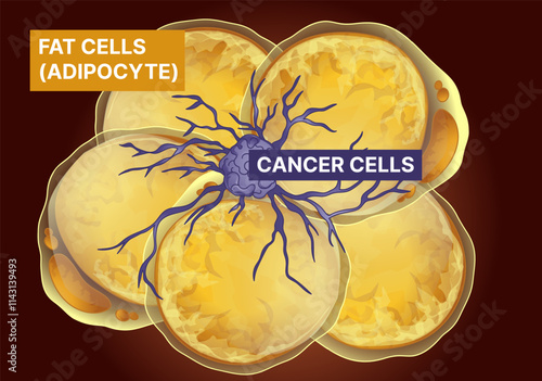 Fat cells, cancer cells. Fat cells Influence tumor. Healthcare illustration. Vector illustration.