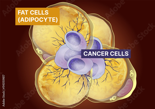 Fat cells, cancer cells. Fat cells Influence tumor. Healthcare illustration. Vector illustration.