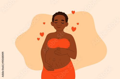 Pregnancy. Pregnant african black skin woman touching her belly with birthmark streches. Motherhood. Happy Mother's Day. Pretty women with tummy. Hand drawn flat cartoon vector illustration