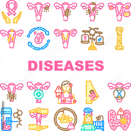 women diseases endometriosis pcos icons set vector. menopause, osteoporosis fibroids, breast cervical, ovarian, uterine infertility, pms women diseases endometriosis pcos color line illustrations
