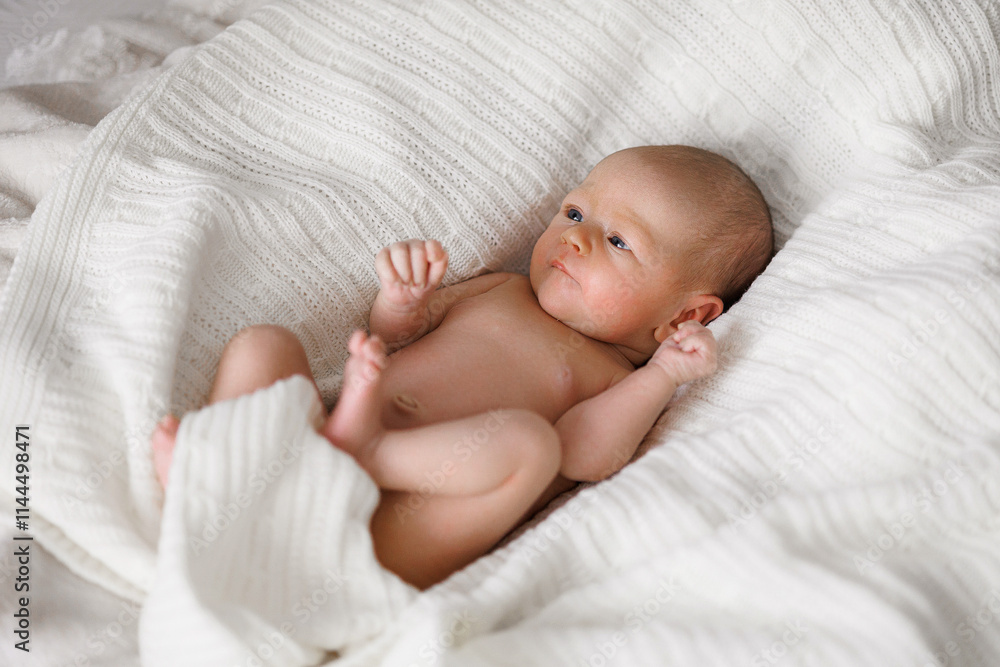 A baby is laying on a white blanket. The baby is naked and has a blue face. The baby is looking at the camera A baby is laying on a white blanket. The baby is naked and has a blue face. The baby is looking at the camera