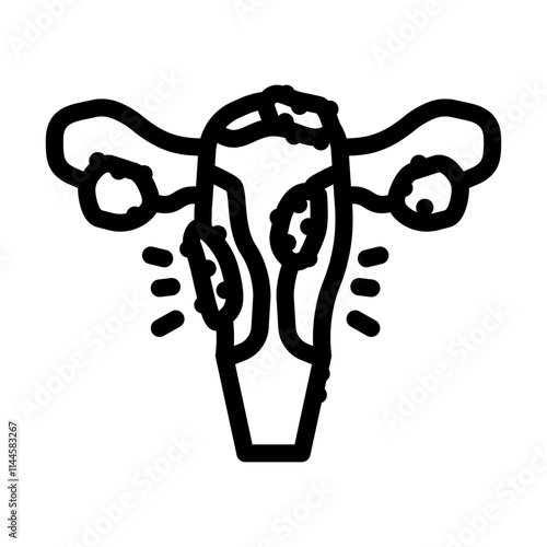 endometriosis woman disease line icon vector. endometriosis woman disease sign. isolated contour symbol black illustration