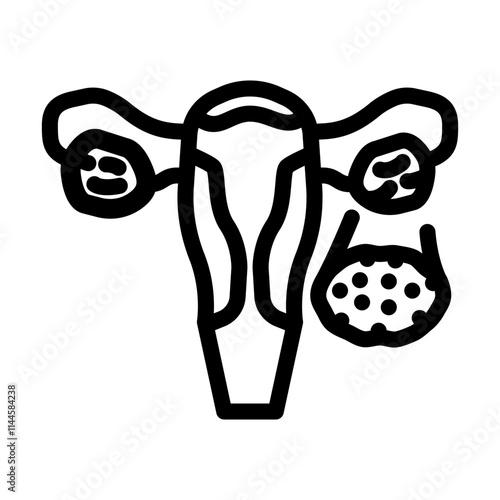 polycystic ovary syndrome woman disease line icon vector. polycystic ovary syndrome woman disease sign. isolated contour symbol black illustration