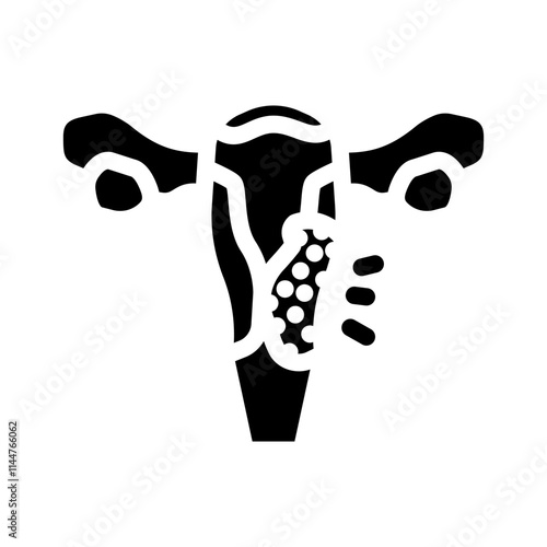 cervical cancer woman disease glyph icon vector. cervical cancer woman disease sign. isolated symbol illustration