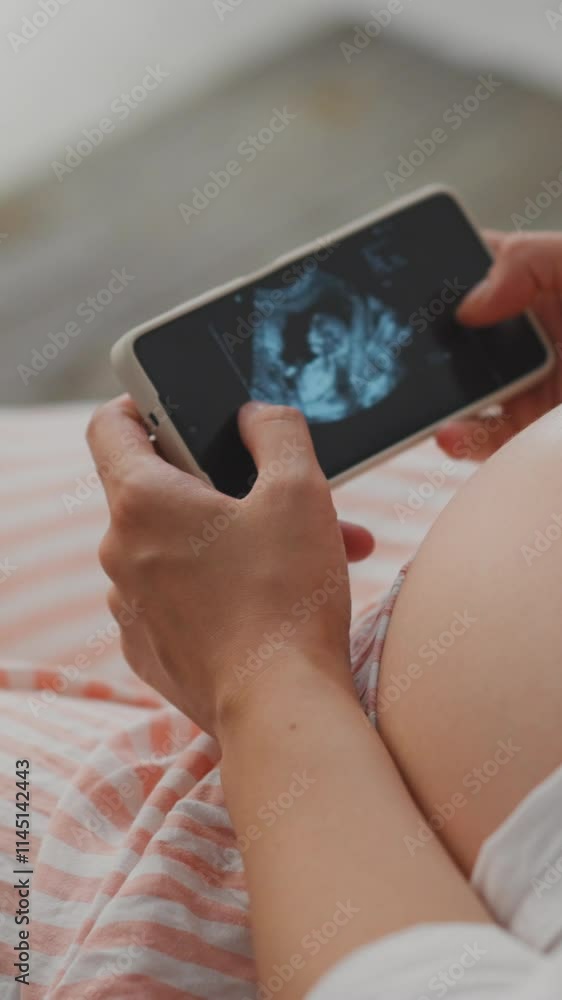 A pregnant woman rests at home, using her smartphone to view an ultrasound image of her baby. She gently cradles her belly, absorbed in the moment of anticipation and joy A pregnant woman rests at home, using her smartphone to view an ultrasound image of her baby. She gently cradles her belly, absorbed in the moment of anticipation and joy