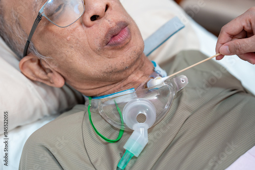 Patients who have undergone a tracheostomy for intubation