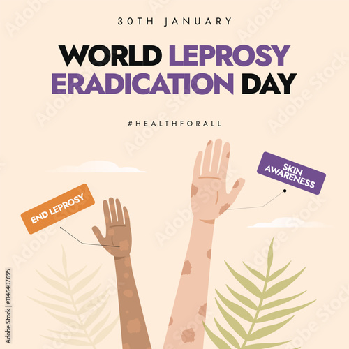 Leprosy Eradication Day. World Leprosy day awareness banner with hands effected by the disease. The day is celebrated to create awareness against the stigma attached to the disease.