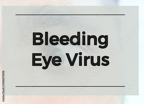 Bleeding Eye Virus term, Marburg virus. Deadly infected virus. photo