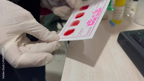 Blood type test