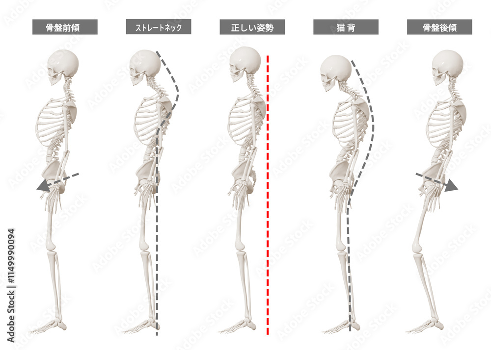 女性の骨格模型の姿勢のイラスト 全身横向き 猫背 ストレートネック 正しい姿勢 骨盤前傾 骨盤後傾