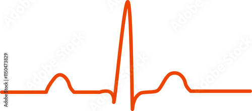 Normal Sinus Rhythm