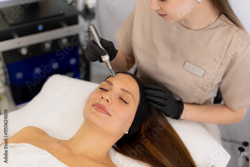 Innovative microneedling me...