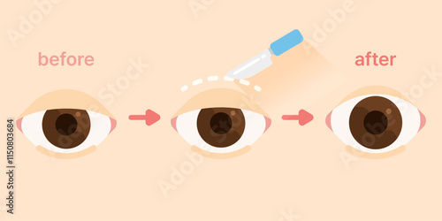 double eyelid surgery blepharoplasty plastic surgery