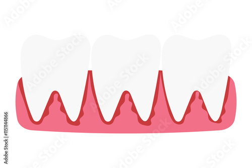 Bleeding gums. Gingivitis and blood, dental concept. Vector.