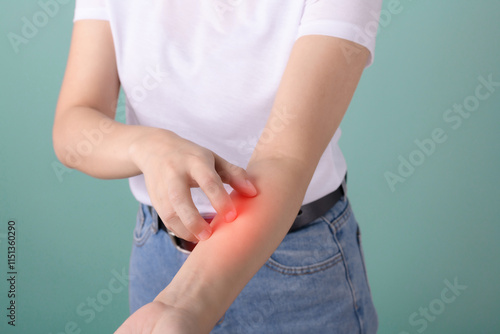Bilde på lerret person scratching their irritated arm with red inflamed area, indicating skin ir