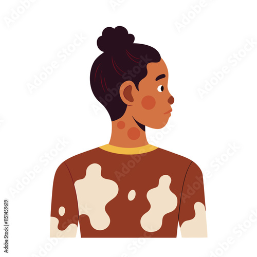 Skin conditions vector illustration