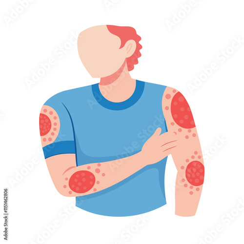 Skin conditions vector illustration