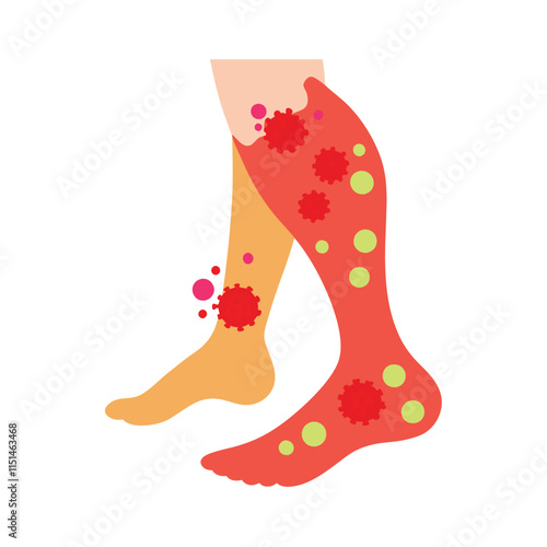 Skin conditions vector illustration