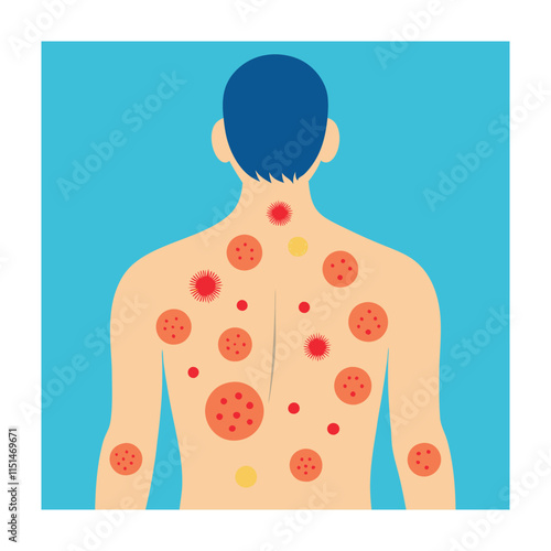 Skin conditions vector illustration