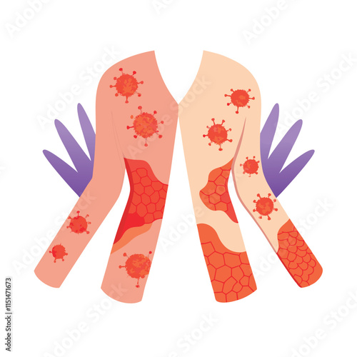 Skin conditions vector illustration