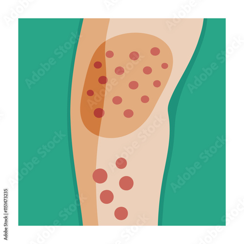 Skin conditions vector illustration