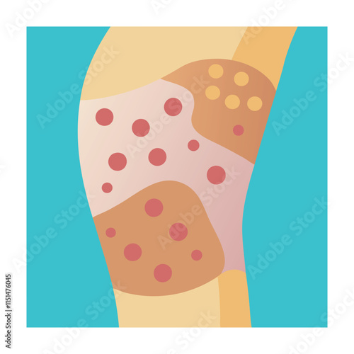 Skin conditions vector illustration
