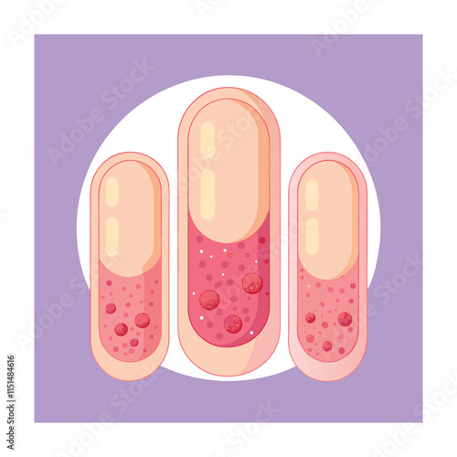 Skin conditions vector illustration