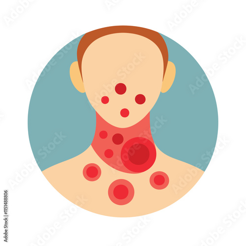 Skin conditions vector illustration