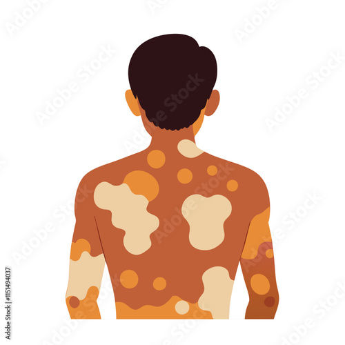 Skin conditions vector illustration