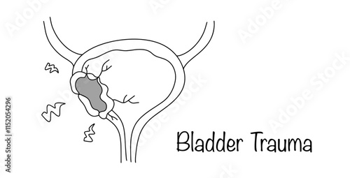 Bladder Trauma