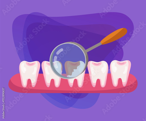 Magnifier in front of tooth with cavity vector illustration. Magnifying glass, bad tooth examination and treatment on purple background. Stomatology or dentistry, health, medicine concept