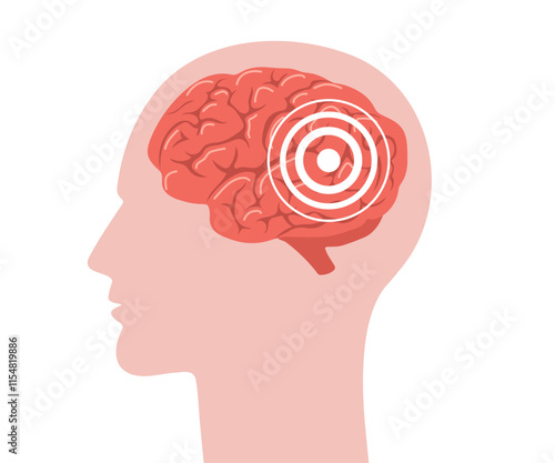 Brain anatomy. Human head in profile with red brain inside. Headache concept. Migraine symbol isolated on white background. Side view. Vector illustration in flat cartoon style.