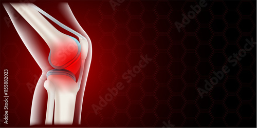 Knee inflammation. joint pain. banner
