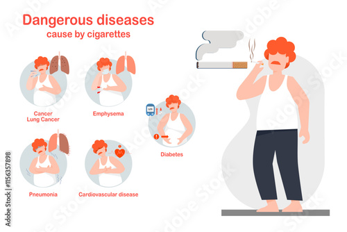 Five dangerous diseases by smoking, flat vector illustration, health care concept.