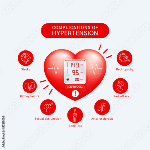 complications of hypertension. Stroke, Retinopathy, Heart attack, Arteriosclerosis, Bone loss, Kidney failure. High blood pressure. Sphygmomanometer in red heart. Medical health care. Vector.