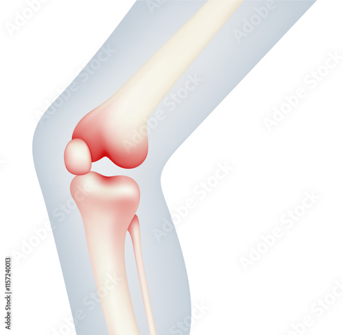 Symptoms of Osteomyelitis Knee Pain