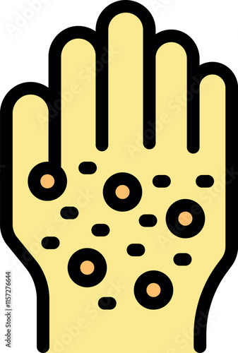 Monkeypox virus causing skin blisters and rashes on a hand, a symptom of the infectious disease