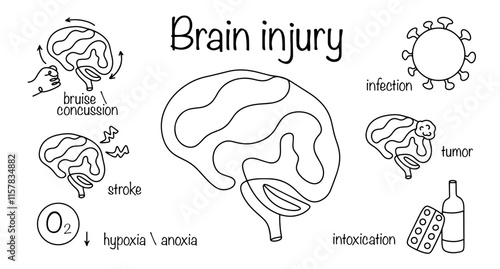Brain injury