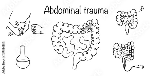 Abdominal trauma